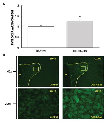 Activation of Orexin 1 Receptors in the Paraventricular Nucleus Contributes to the Development of Deoxycorticosterone Acetate-Salt Hypertension Through Regulation of Vasopressin